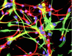 Neurons Get Help From Their Friends